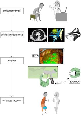 What’s new in minimally invasive thoracic surgery? Clinical application of augmented reality and learning opportunities in surgical simulation